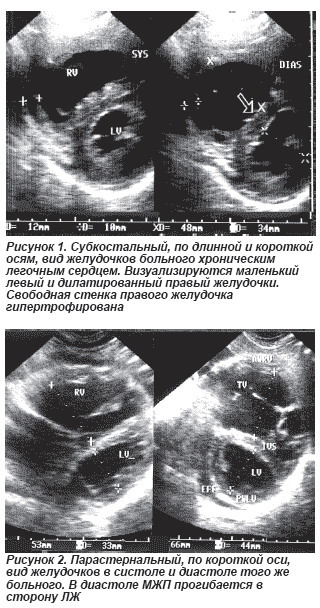 новолунная диета 2012