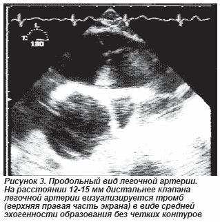 аллен карр легкий способ похудеть читать