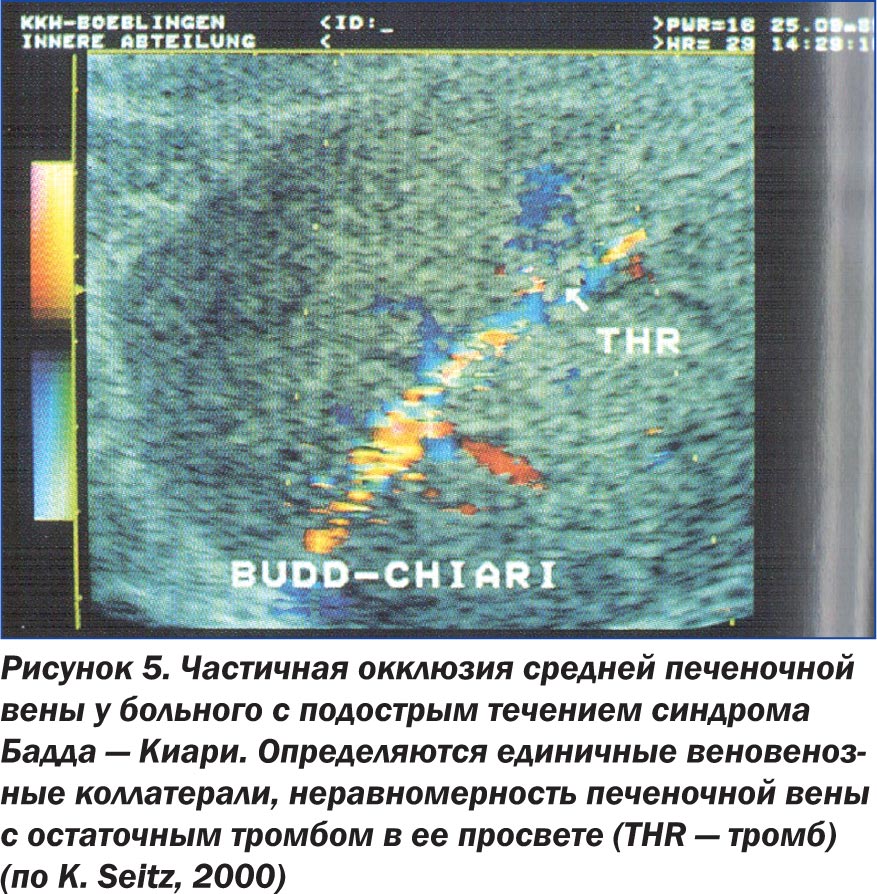 гипоаллергенная диета кормящей