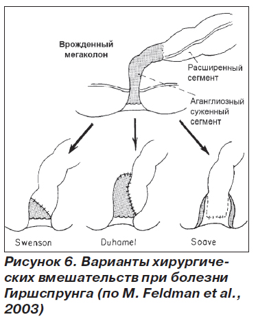 камни в почках диета фосфаты