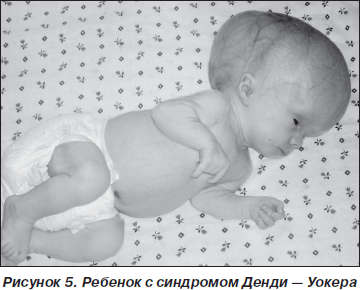 Родился с очень редким синдромом: во Львове прооперировали мальчика из Чернобаевки