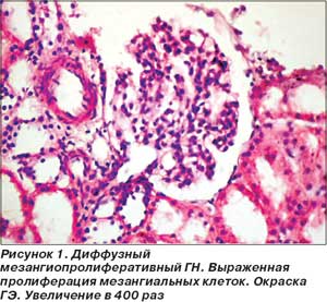 молочно-растительная диета при крапивнице