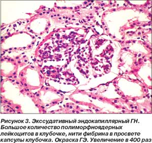 гастродуоденит симптомы лечение диета