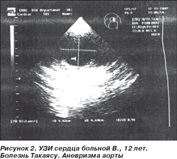 лечебное питание диета no5п