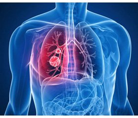 Drug management of oxidation-reduction state of the body in respiratory tract diseases (part 4)
