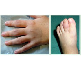 Modern concepts of vitamin D role in juvenile idiopathic arthritis in children  (review)