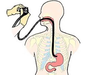 Modern possibilities of urgent fibroesophagogastroduodenoscopy in the diagnostic  and therapeutic algorithm in patients with acute surgical pathology