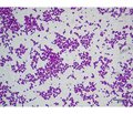 Development of the immune response in pneumonia due to Staphylococcus aureus  (part 1)