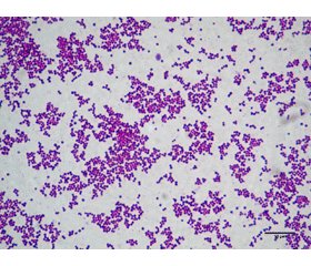 Development of the immune response in pneumonia due to Staphylococcus aureus  (part 1)