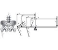 Клинико-биомеханическое обоснование и построение модели работы мышц, обеспечивающих горизонтальное  равновесие таза