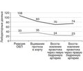 Клинический случай успешного лечения больного с разрывом аневризмы дистального отдела аорты и массивной кровопотерей