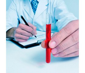 Особливості біохімічних показників крові та цитокінового профілю у хворих на неалкогольну жирову хворобу печінки залежно від форми гіпотиреозу
