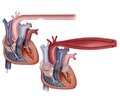 Эффективная кардио- и вазопротекция шестимесячной комбинированной терапии индапамидом с амлодипином и блокатором РААС у больных с эссенциальной гипертонией высокого риска