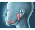 Biochemical indicators of oral fluid in school-age children with a combined course of caries and chronic generalized catarrhal gingivitis under the influence of treatment and prophylactic measures