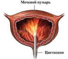 Важливість корекції вегетативної дисфункції у дітей  із розладами сечовипускання, або  як підвищити ефективність терапії гіперактивного сечового міхура