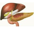 Priority directions in the treatment of patients with acute pancreatitis