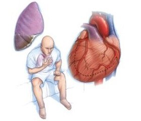 Гостра серцева недостатність і кардіогенний шок: сучасні принципи діагностики та лікування