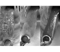 Бактоблис® (Streptococcus salivarius K12) — инновационная терапия и профилактика острых респираторных инфекций и их осложнений