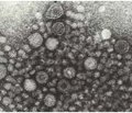 Клініко-епідеміологічні особливості перебігу інвазивних діарей, викликаних Escherichia coli, у дітей Запорізької області