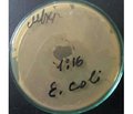 Антибактериальные и антисептические свойства вагинального душа Дреагин Бакт™ в эксперименте (in vitro)