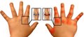 A systemic type of juvenile idiopathic (rheumatoid) arthritis in children and adolescents: new in the treatment (review of literature and own observations)