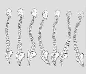 Peculiarities muscle imbalance in patients with Scheuermann’s disease with different variants of the spine sagittal contour