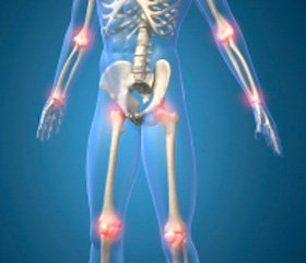 Obesity-Induced Osteoarthritis: the Multifactorial Interrelation and the Leading Role of Adipokines, Dyslipidemia and Mechanical Loading