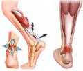 Diagnosis of Strain (Rupture of Ligaments) of Ankle Joint in Children with the Help of Computer Simulation