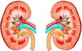 Possibilities of the Early Diagnosis of Nephrosclerosis in Children Up To 3 Years in the Period  of Complete Remission of Acute Uncomplicated Pyelonephritis