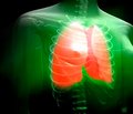 Respiratory Distress Syndrome: Current Issues of Definitions, Clinical Presentation, Diagnostic Algorithm