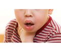 Особливості розвитку, перебігу й принципи діагностики харчової анафілаксії у дітей раннього віку