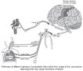 Features of autonomic disorders in patients with COVID-19