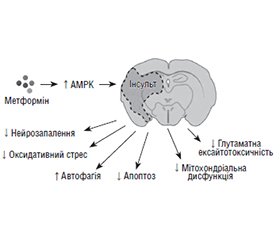 Інсулінорезистентність і мозковий інсульт: механізми та терапевтичні підходи