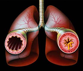 Basic aspects study risk factors for diseases of the respiratory tract at children of early and preschool age.