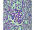 Можливість використання стовбурових клітин при трансплантації нирки: експериментальні дослідження (огляд літератури)