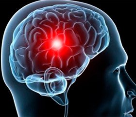 Динамика когнитивных функций и биомаркеров ишемии мозга при лечении кортексином пациентов с хронической сосудисто-мозговой патологией