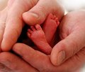 Коррекция отрицательного йодного баланса преждевременно родившихся детей в неонатальном периоде путем введения в рацион матерей йодсодержащих препаратов