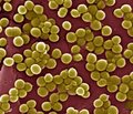 MRSA — знаменитый и неизвестный Метициллин- резистентный S.aureus: механизмы резистентности, лабораторная диагностика, клиника и эпидемиология