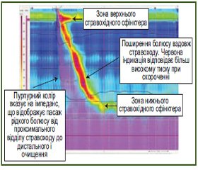 Еволюція зондових методів досліджень в гастроентерології: огляд і власні дослідження