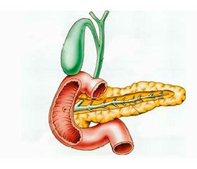 Annular pancreas associated with torch-infection.