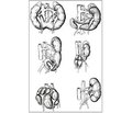 Congenital Anomalies of Kidney Position and Rotation: the Prevalence, Etiopathogenesis, Prenatal Diagnosis, Clinical Picture, Physical Development, Diagnosis, Treatment and Prevention
