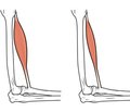 Sarcopenia falls and fractures