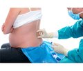 The place of dural puncture epidural as a modern method of pain relief in labor