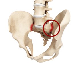 Диагностика синдрома крестцово-подвздошных суставов