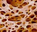 Results from monitoring studies of students bone tissue structure and function at Kharkiv region