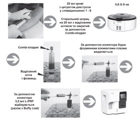 Методика отримання PRP та L-PRP для використання в повсякденній практиці лікаря ортопеда-травматолога