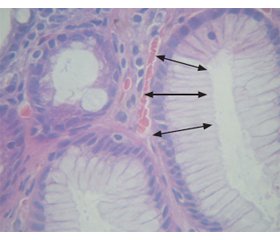 Морфофункціональні паралелі шлунка у хворих на хронічний атрофічний гастрит