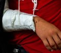 Использование нейрометрии для оценки восстановления иннервации поврежденной конечности в различные сроки после оперативного лечения