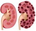 Renoprotection and its association  with eGFR and renal functional reserve