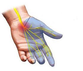 Туннельные невропатии. Трудности диагностики и терапии